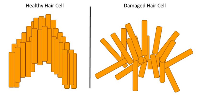 Age-related hearing loss could be helped by regenerating hair cells, study suggests