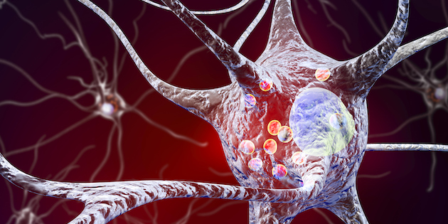 “Most diverse” UK study yet identifies hearing loss as early sign of Parkinson’s “Most diverse” UK study yet identifies hearing loss as early sign of Parkinson’s