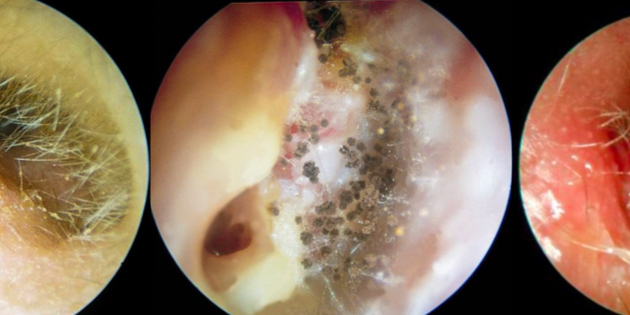 Part One of two concise outlines on DISORDERS OF THE EAR