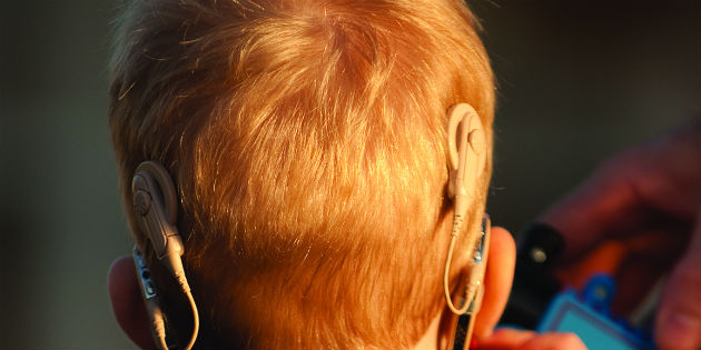 Cochlear implants for true binaural hearing
