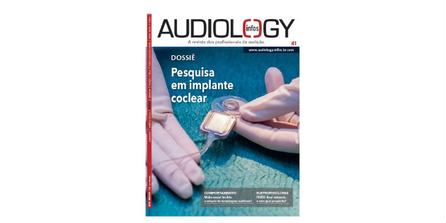Cochlear implants: the focus of the latest issue of Audiology Infos Brazil Cochlear implants: the focus of the latest issue of Audiology Infos Brazil
