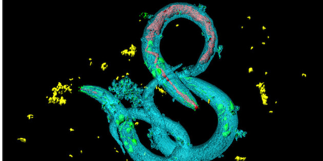 Study of earless worm’s auditory capacity brings new tool into view for hearing research Study of earless worm’s auditory capacity brings new tool into view for hearing research