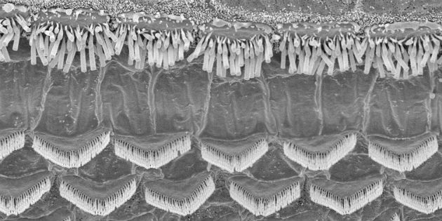 New drug combination to regenerate hair cells New drug combination to regenerate hair cells