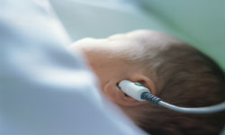 Newborn hearing screening: study in 151 countries