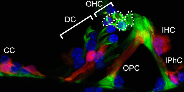 Kobe University research finds cellular key to acquired hearing loss, opening door to prevention and treatment