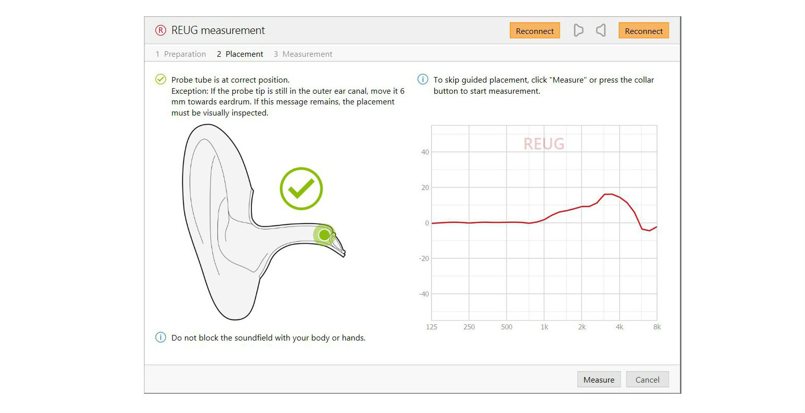 Phonak releases 2nd generation of TargetMatch with Target 5.1